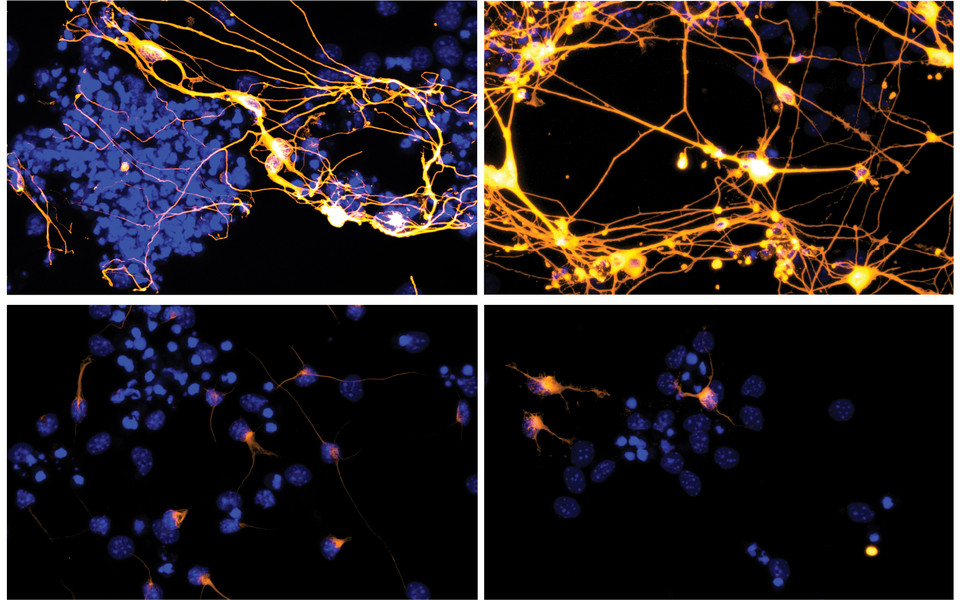 Neuronal networks (upper panels) cannot be formed without PHF3 (lower panels). (c) Appel et.al. 2021