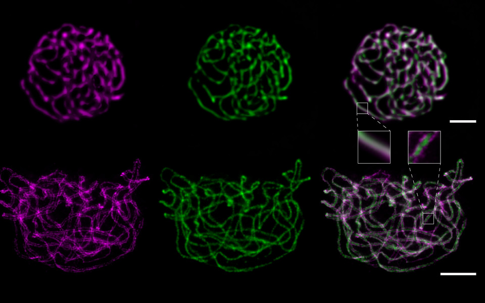 STED nanoscopy reveals substructures of the synaptonemal complex.