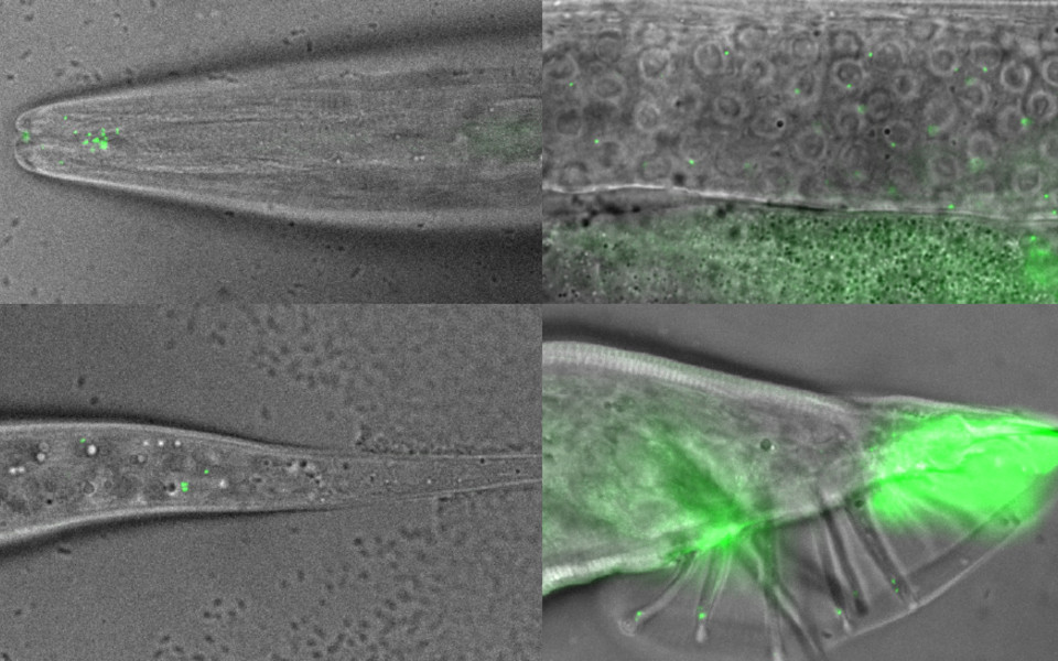 The centrosome scaffolding protein forms foci at the ciliary base of sensory neurons in the head and tail of the nematode worm C. elegans. Unlike centrosomes in the germline and early embryo, those PCM accumulations are not built around the core organizing structure of the centrioles. & copyright: Adapted from Garbrecht, Laos et al., Curr Biol 2021