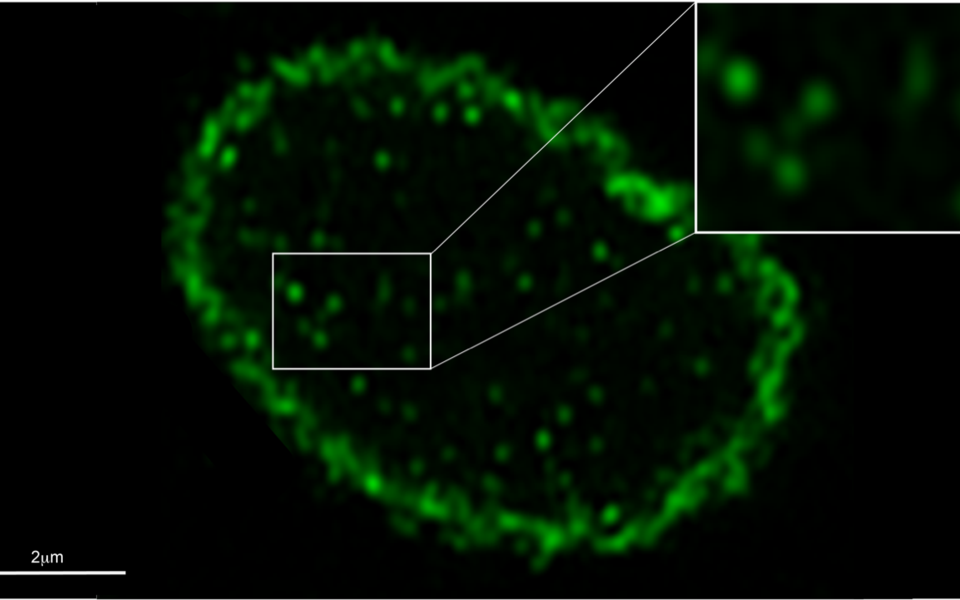 Insoluble and stable higher-order lamin A/C structures in the nuclear interior of LAP2alpha KO cells revealed by super resolution immunofluorescence microscopy (c) Nana Naetar, Foisner Lab