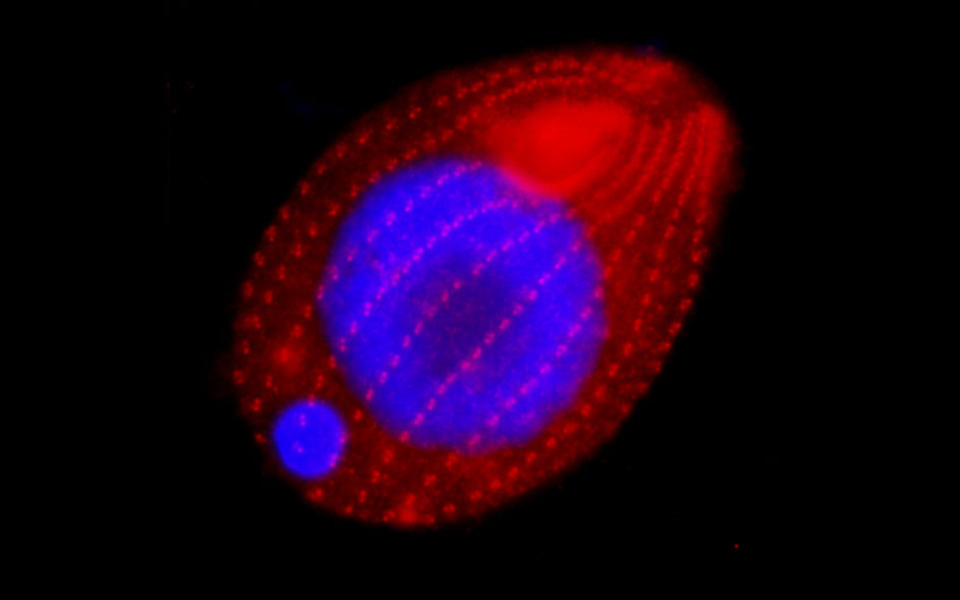 Tetrahymena thermophila